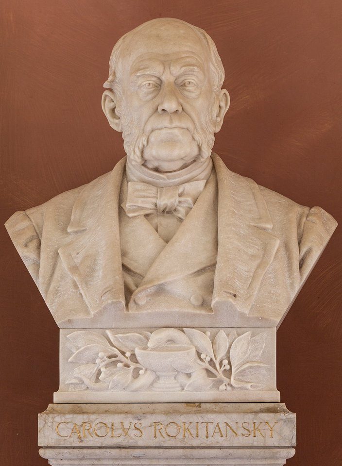 Karl%20von%20Rokitansky%27s%20bust%2C%20University%20of%20Vienna%20%28by%20Julia%20Rudiger%29.jpg